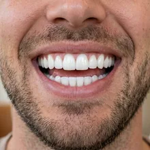 Estética dental — sonrisa luminosa