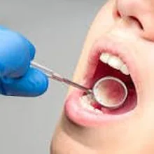 Odontología general — revisión bucal