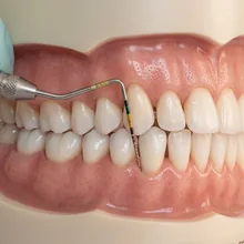 Periodoncia — salud de encías